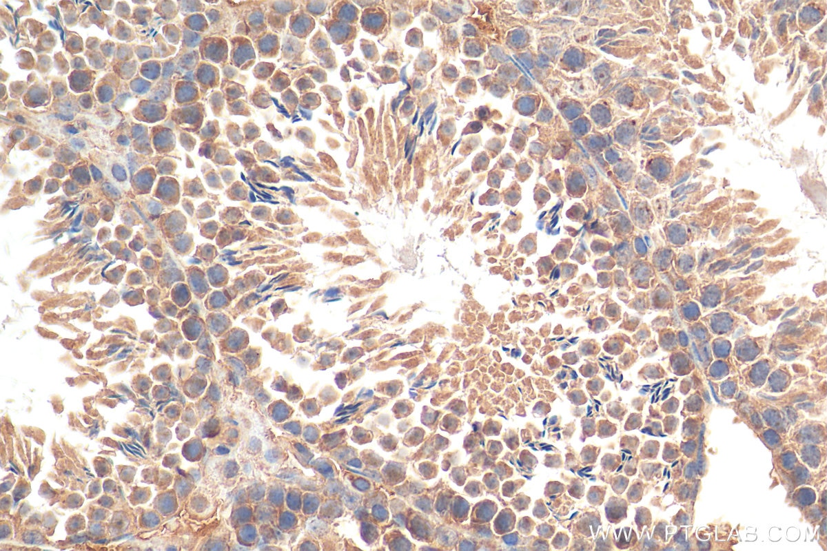 Immunohistochemistry (IHC) staining of mouse testis tissue using PLK4 Polyclonal antibody (28750-1-AP)