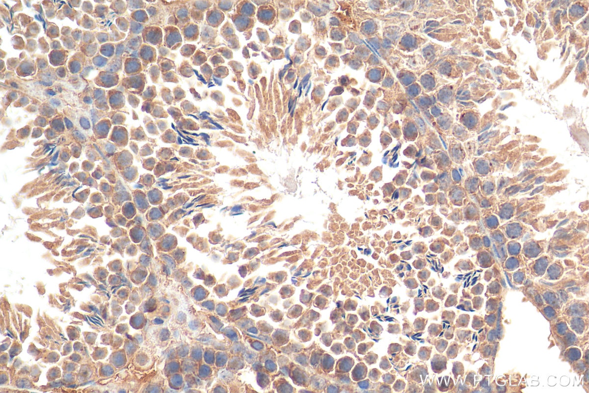 IHC staining of mouse testis using 28750-1-AP