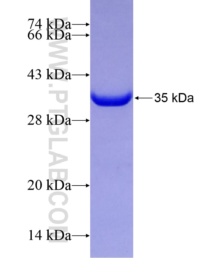 PLK4 fusion protein Ag21287 SDS-PAGE