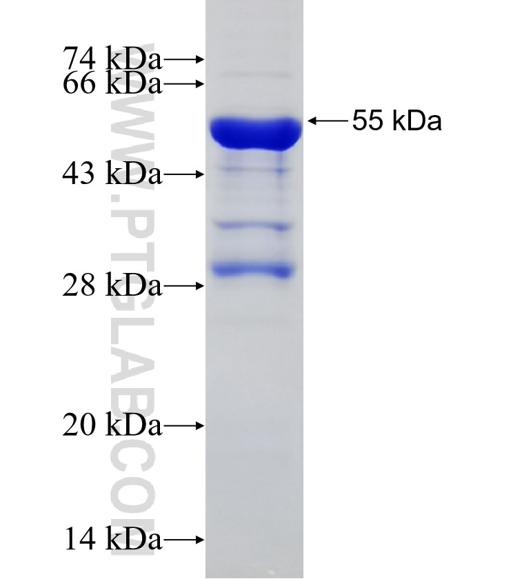 PLK4 fusion protein Ag3605 SDS-PAGE