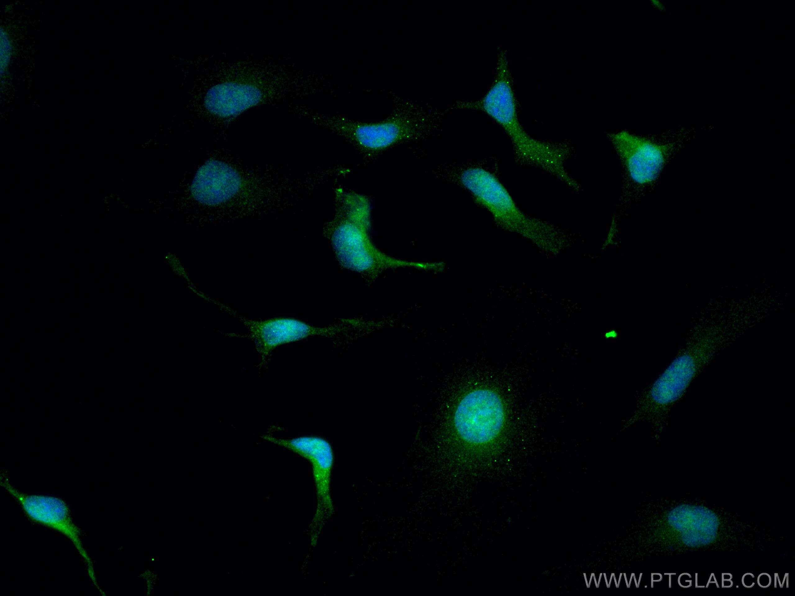 Immunofluorescence (IF) / fluorescent staining of HeLa cells using PLK5 Polyclonal antibody (21299-1-AP)
