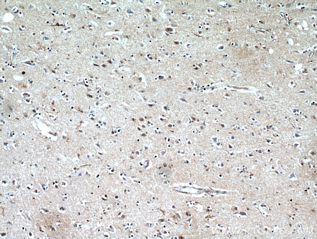 Immunohistochemistry (IHC) staining of human brain tissue using PLK5 Polyclonal antibody (21299-1-AP)