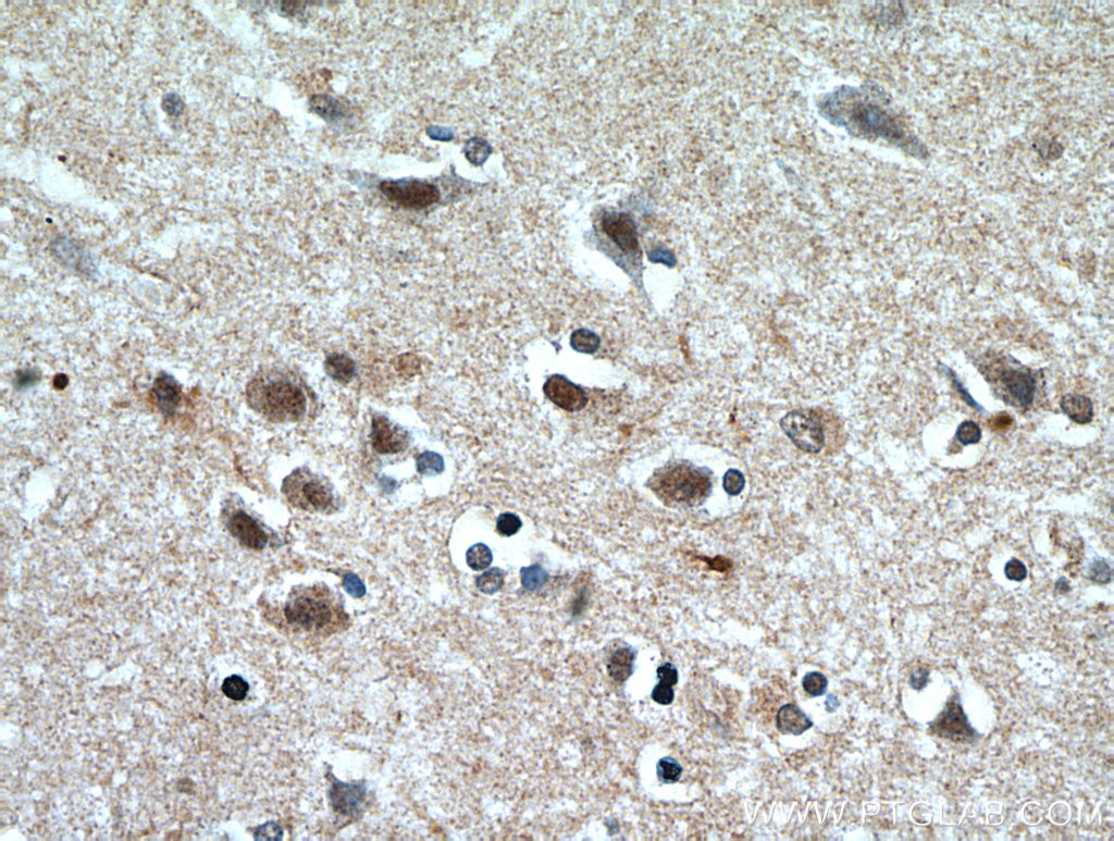 Immunohistochemistry (IHC) staining of human brain tissue using PLK5 Polyclonal antibody (21299-1-AP)