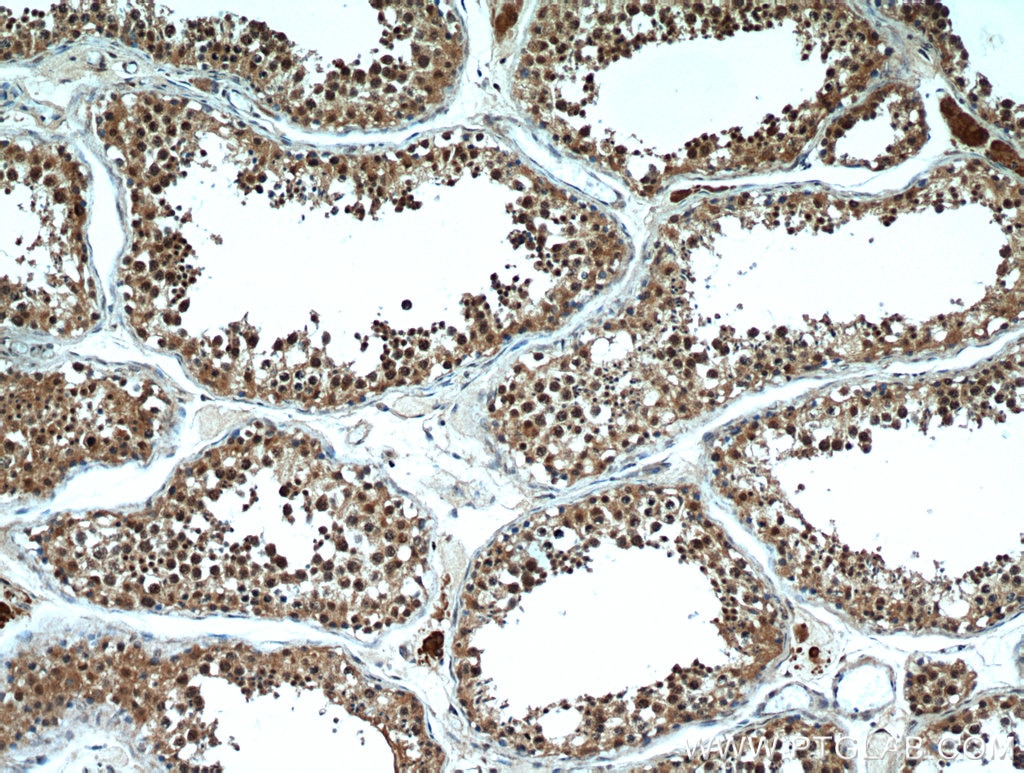 IHC staining of human testis using 21299-1-AP