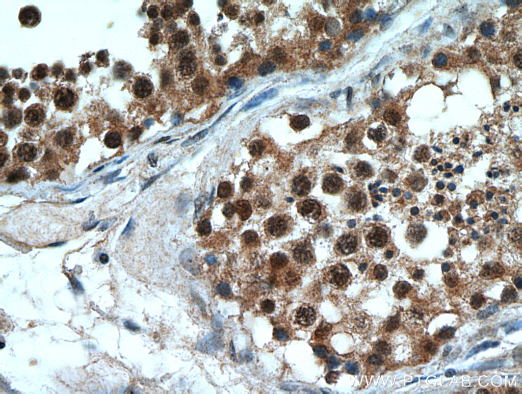 Immunohistochemistry (IHC) staining of human testis tissue using PLK5 Polyclonal antibody (21299-1-AP)