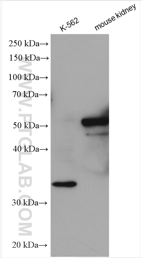Western Blot (WB) analysis of various lysates using PLK5 Polyclonal antibody (21299-1-AP)