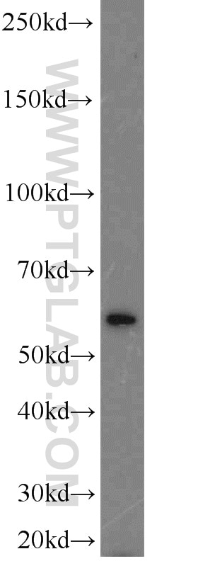Western Blot (WB) analysis of mouse testis tissue using PLK5 Polyclonal antibody (21299-1-AP)