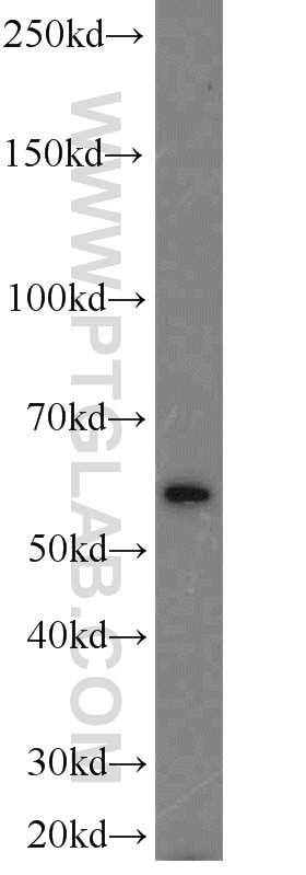 WB analysis of mouse testis using 21299-1-AP