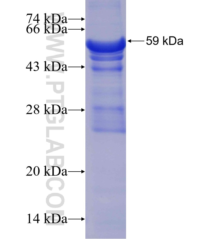 PLK5P fusion protein Ag15881 SDS-PAGE