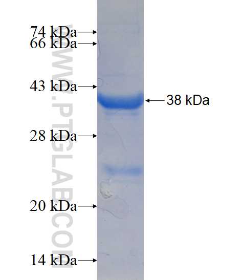 PLK5P fusion protein Ag16722 SDS-PAGE