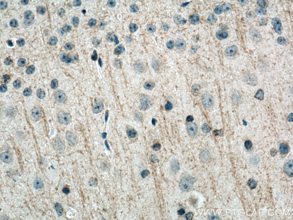 Immunohistochemistry (IHC) staining of mouse brain tissue using Plasmolipin Polyclonal antibody (14868-1-AP)