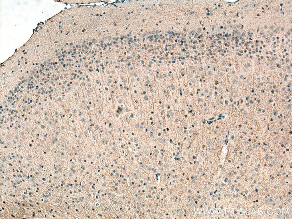 Immunohistochemistry (IHC) staining of mouse brain tissue using Plasmolipin Polyclonal antibody (14868-1-AP)