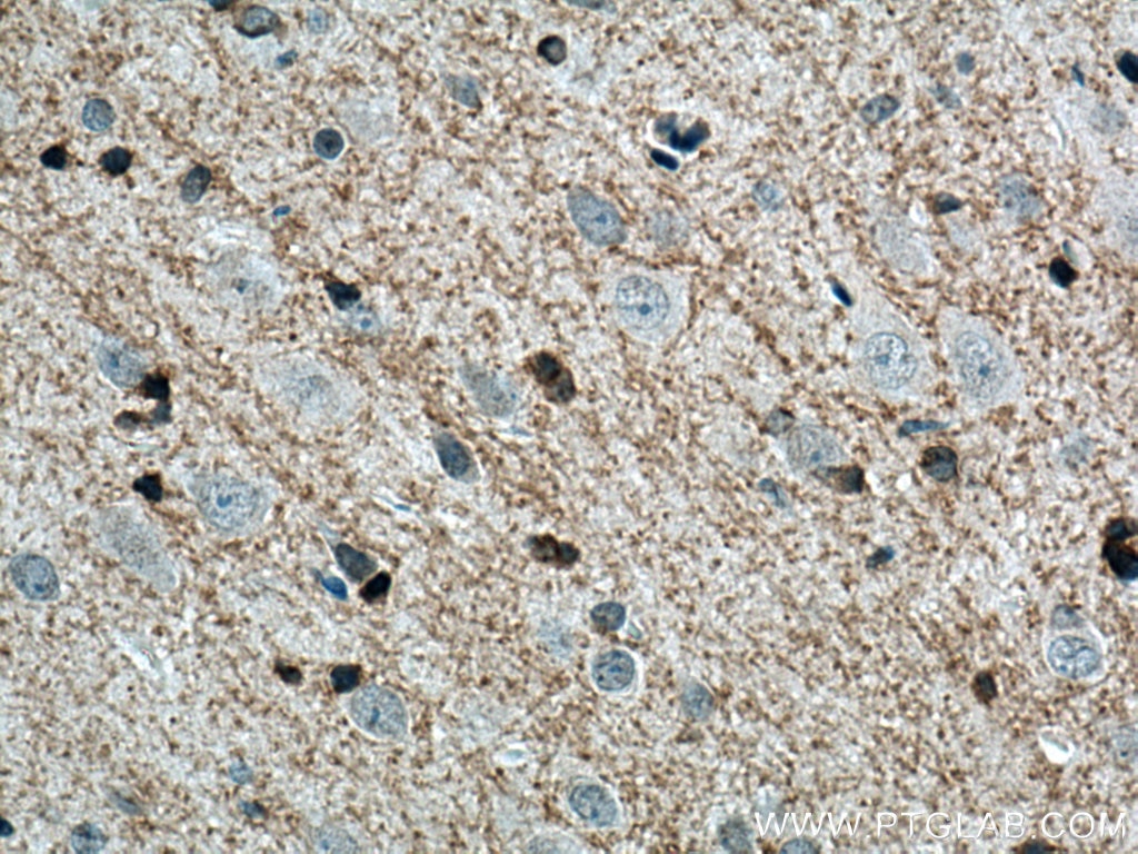 Immunohistochemistry (IHC) staining of rat brain tissue using Plasmolipin Polyclonal antibody (14868-1-AP)