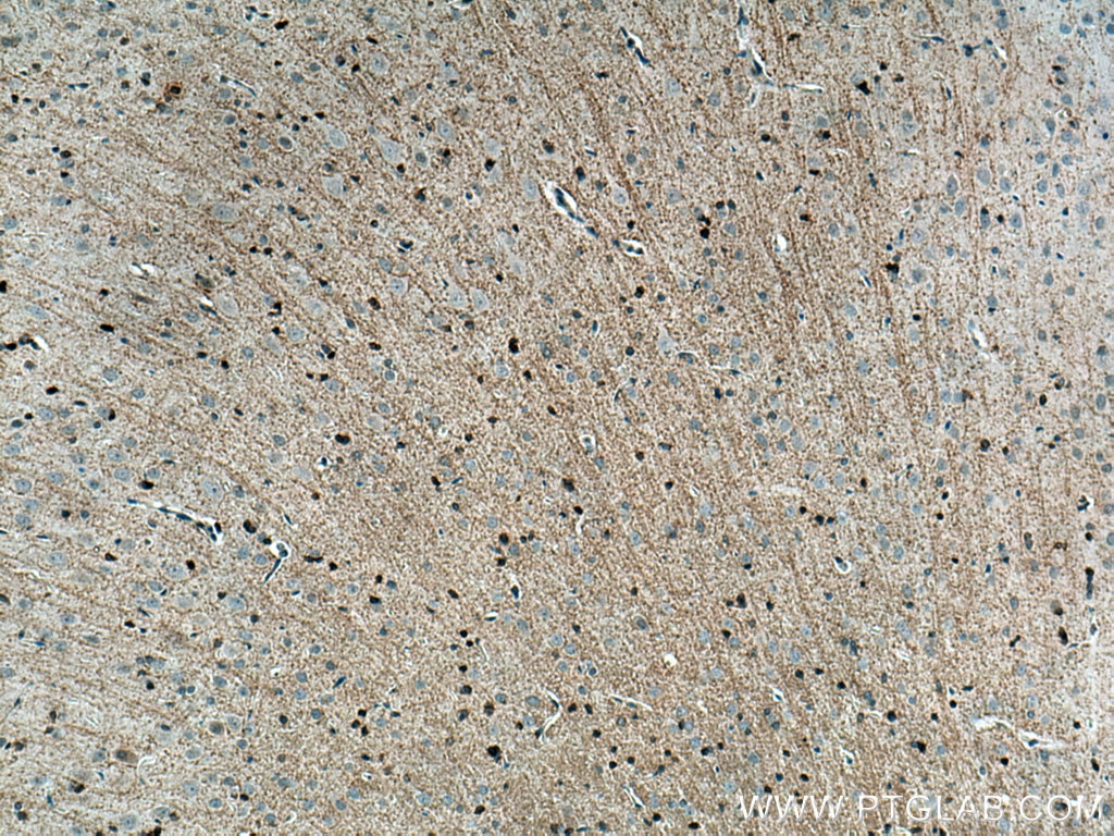 Immunohistochemistry (IHC) staining of rat brain tissue using Plasmolipin Polyclonal antibody (14868-1-AP)