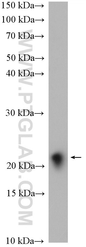 Western Blot (WB) analysis of rat brain tissue using Plasmolipin Polyclonal antibody (14868-1-AP)