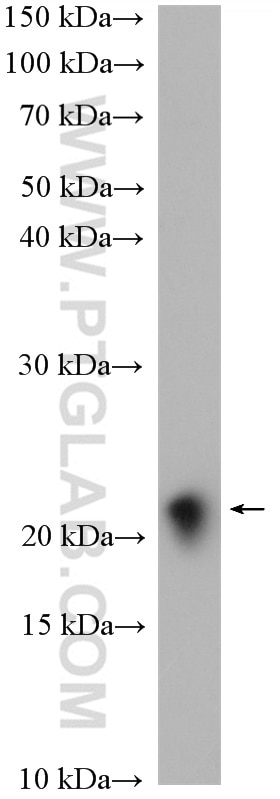 WB analysis of rat brain using 14868-1-AP