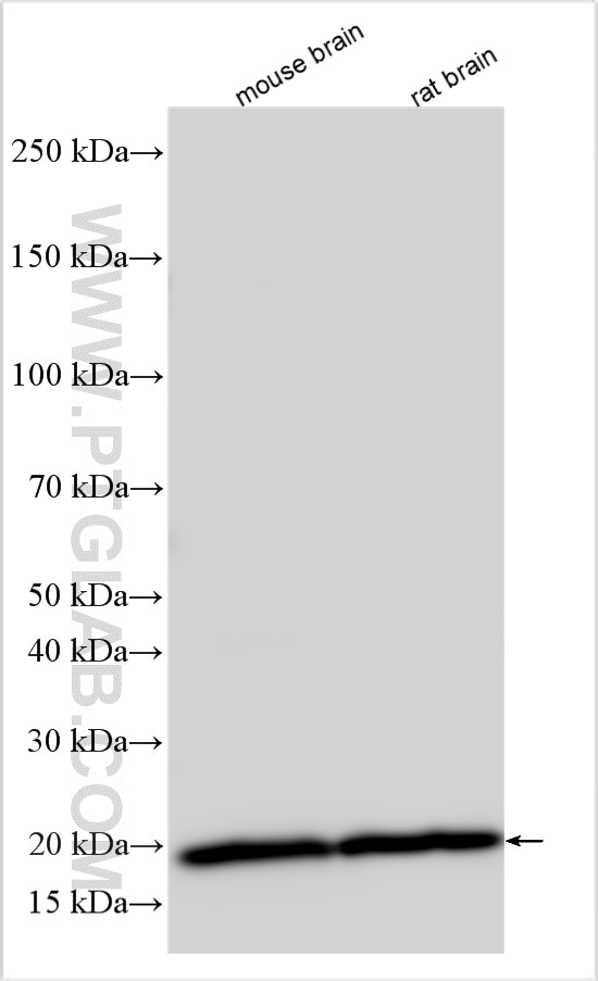 WB analysis using 14868-1-AP Western Blot (WB) analysis of various lysates using Plasmolipin Polyclonal antibody (14868-1-AP)