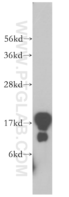 Western Blot (WB) analysis of human testis tissue using Plasmolipin Polyclonal antibody (14868-1-AP)