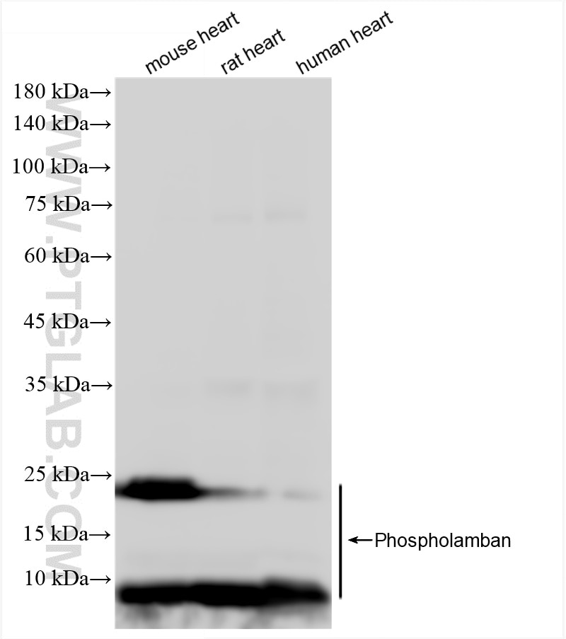 Western Blot (WB) analysis of various lysates using PLN Recombinant monoclonal antibody (86080-1-RR)