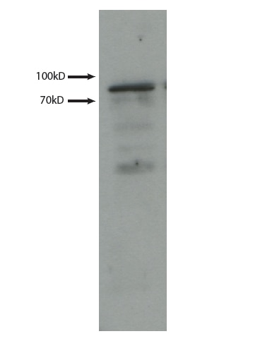 WB analysis of Fibroblasts cells using 12475-1-AP