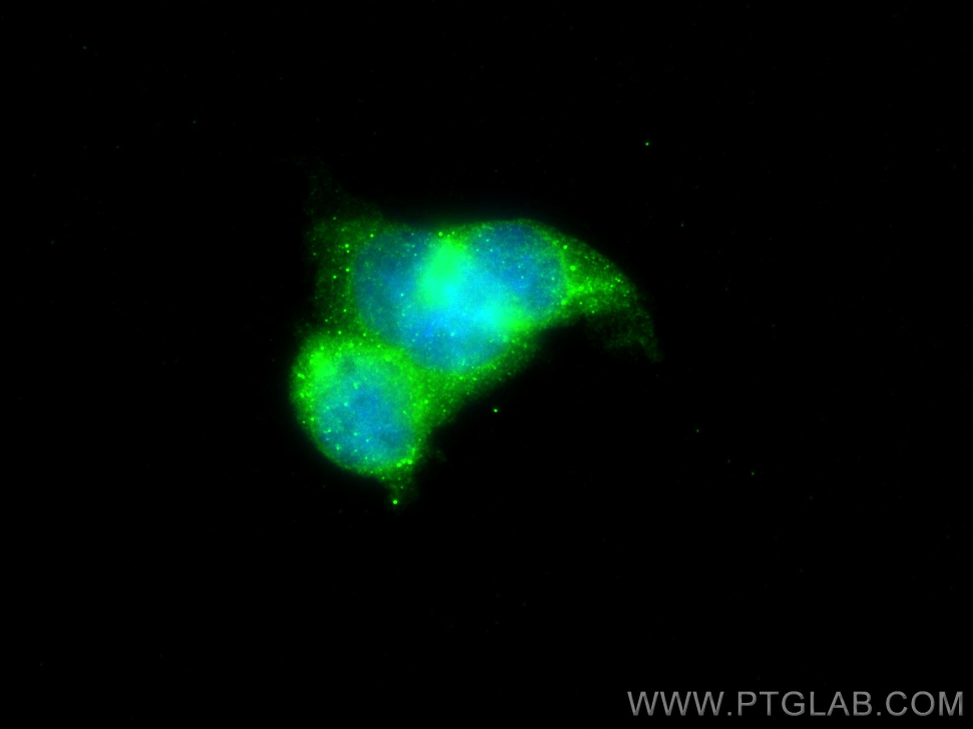 Immunofluorescence (IF) / fluorescent staining of K-562 cells using PLOD1 Polyclonal antibody (29480-1-AP)