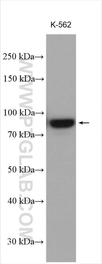 Western Blot (WB) analysis of various lysates using PLOD1 Polyclonal antibody (29480-1-AP)