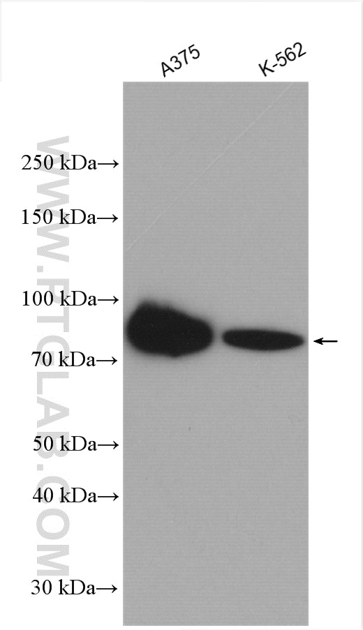 Western Blot (WB) analysis of various lysates using PLOD1 Polyclonal antibody (29480-1-AP)
