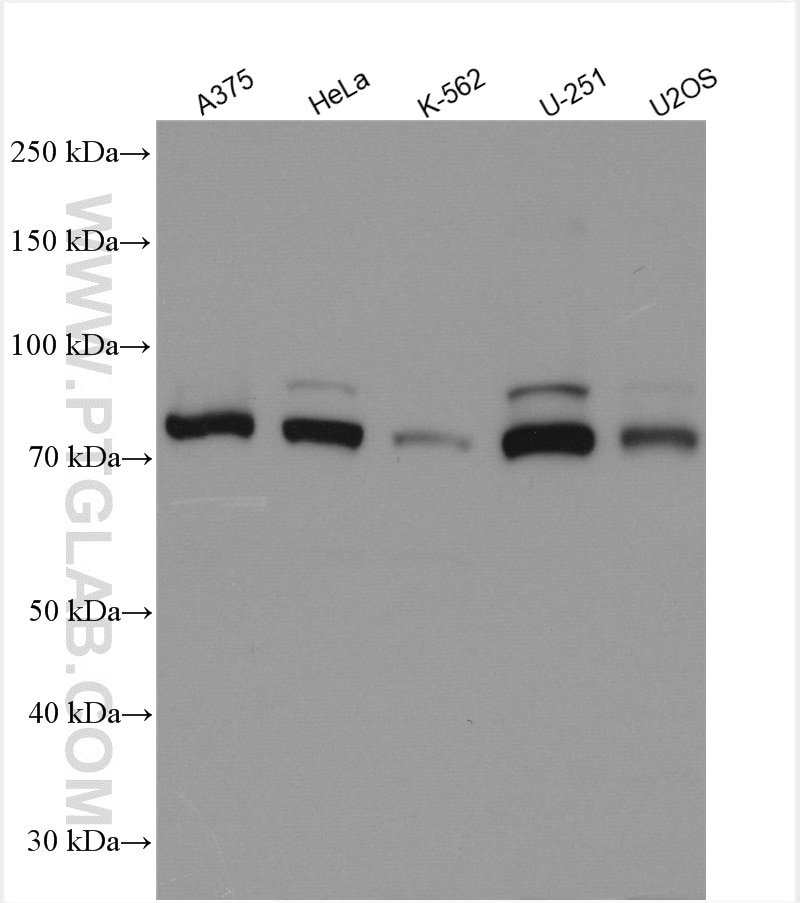 Western Blot (WB) analysis of various lysates using PLOD1 Polyclonal antibody (29480-1-AP)