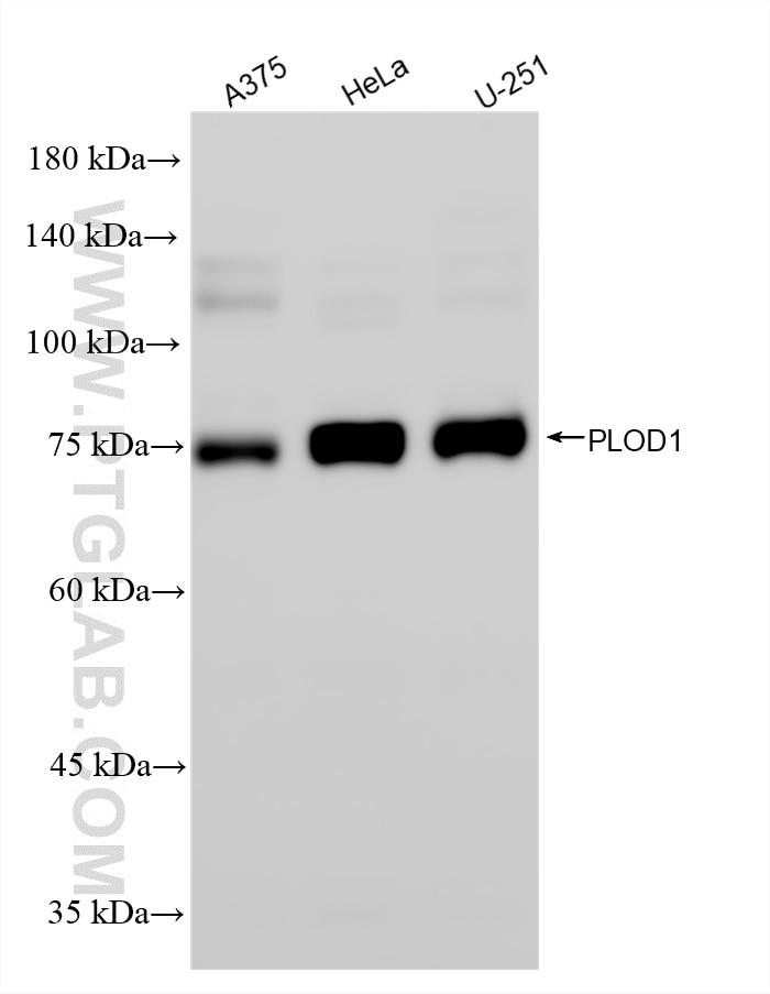 WB analysis using 85662-6-RR Western Blot (WB) analysis of various lysates using PLOD1 Recombinant monoclonal antibody (85662-6-RR)