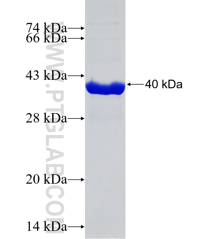PLOD1 fusion protein Ag31626 SDS-PAGE