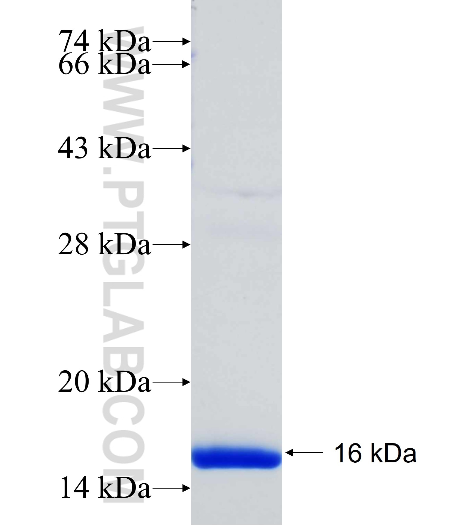 PLOD1 fusion protein Ag31634 SDS-PAGE PLOD1 fusion protein Ag31634 SDS-PAGE