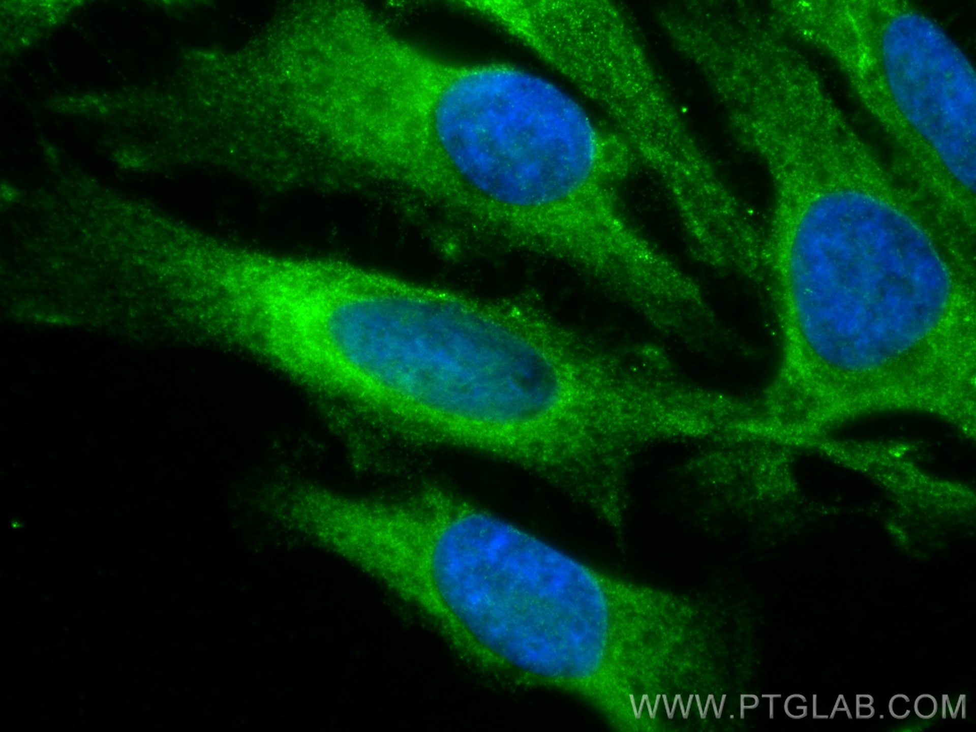 Immunofluorescence (IF) / fluorescent staining of HeLa cells using PLOD2-Specific Polyclonal antibody (21214-1-AP)