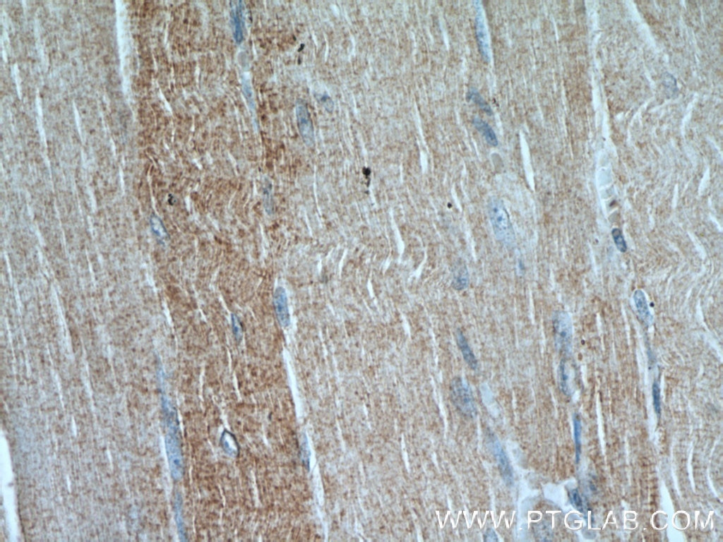 Immunohistochemistry (IHC) staining of human skeletal muscle tissue using PLOD2-Specific Polyclonal antibody (21214-1-AP)