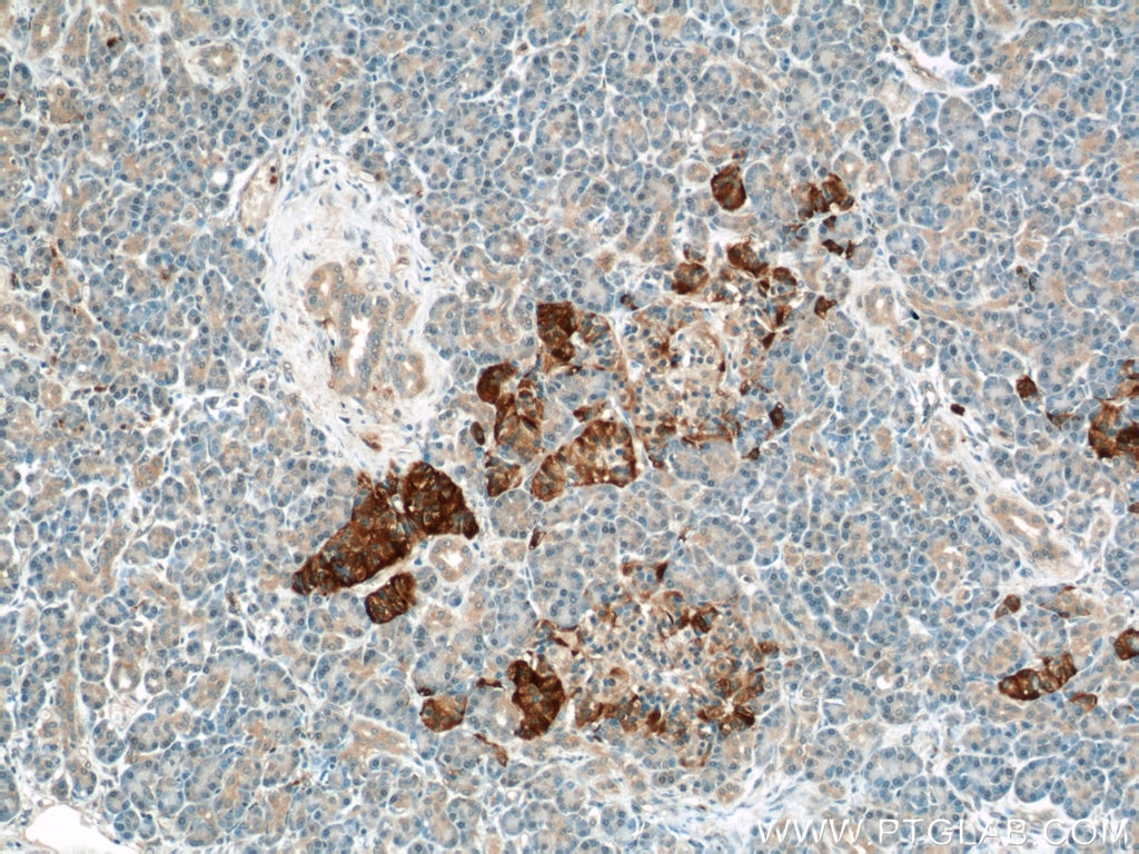 Immunohistochemistry (IHC) staining of human pancreas tissue using PLOD2-Specific Polyclonal antibody (21214-1-AP)