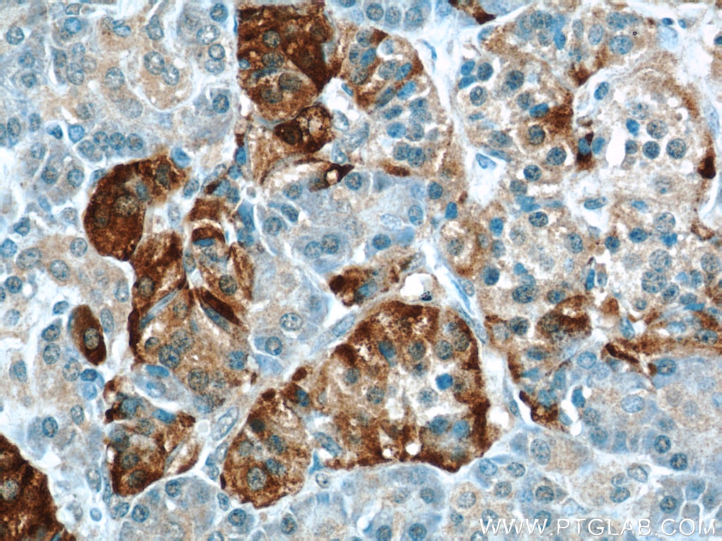 Immunohistochemistry (IHC) staining of human pancreas tissue using PLOD2-Specific Polyclonal antibody (21214-1-AP)