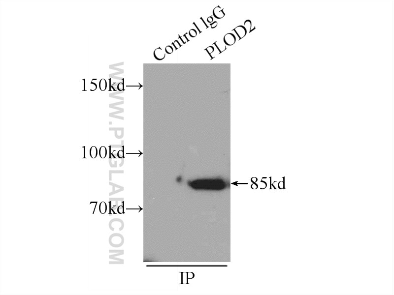 Immunoprecipitation (IP) experiment of mouse testis tissue using PLOD2-Specific Polyclonal antibody (21214-1-AP)