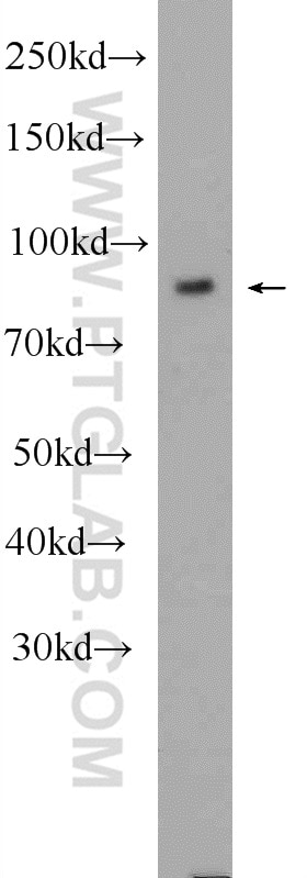 Western Blot (WB) analysis of HT-1080 cells using PLOD2-Specific Polyclonal antibody (21214-1-AP)