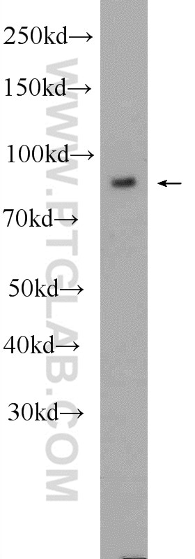 Western Blot (WB) analysis of HT-1080 cells using PLOD2-Specific Polyclonal antibody (21214-1-AP)