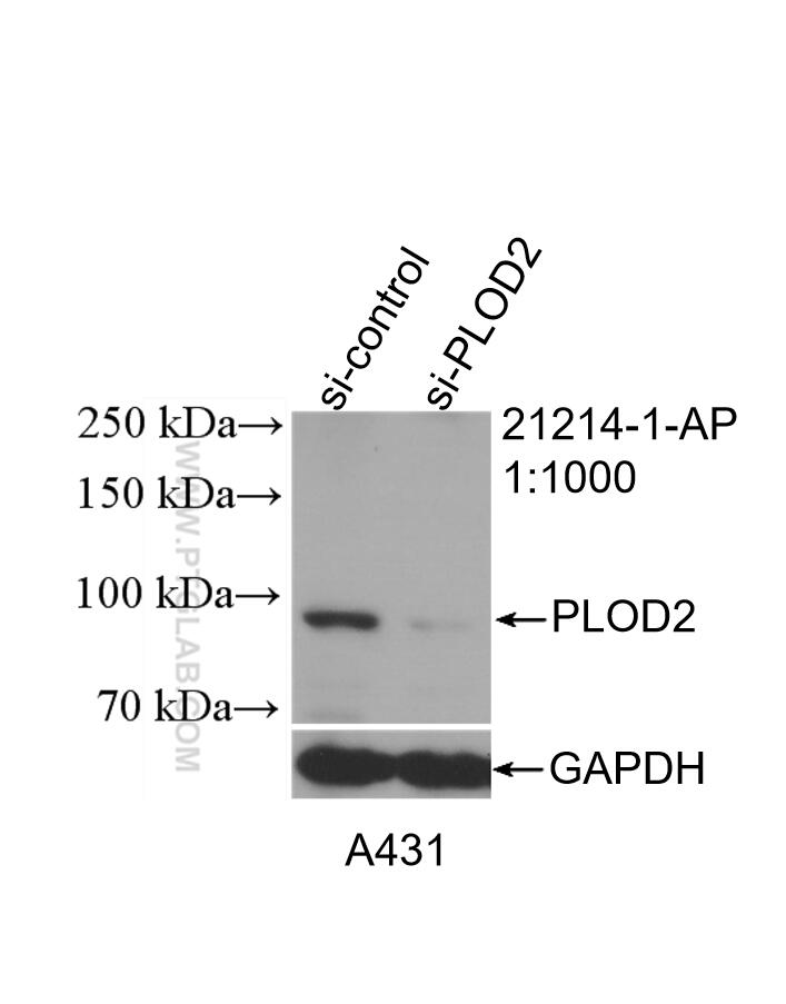 Western Blot (WB) analysis of A431 cells using PLOD2-Specific Polyclonal antibody (21214-1-AP)