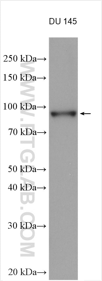 Western Blot (WB) analysis of various lysates using PLOD2-Specific Polyclonal antibody (21214-1-AP)