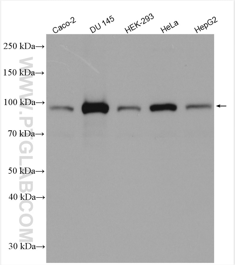 Western Blot (WB) analysis of various lysates using PLOD2-Specific Polyclonal antibody (21214-1-AP)