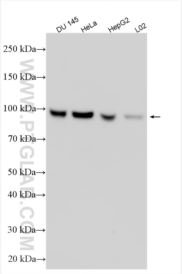 WB analysis using 21214-1-AP Western Blot (WB) analysis of various lysates using PLOD2 Polyclonal antibody (21214-1-AP)