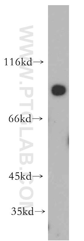 PLOD2-Specific Polyclonal antibody