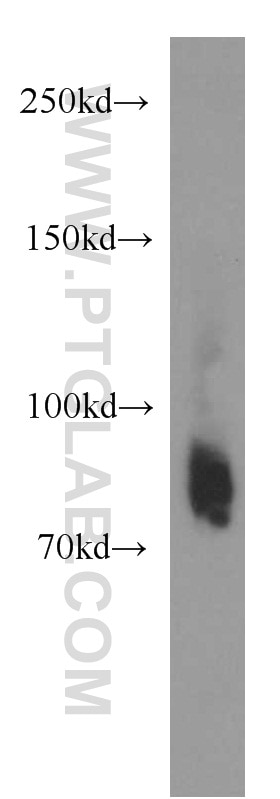 Western Blot (WB) analysis of mouse pancreas tissue using PLOD2-Specific Polyclonal antibody (21214-1-AP)