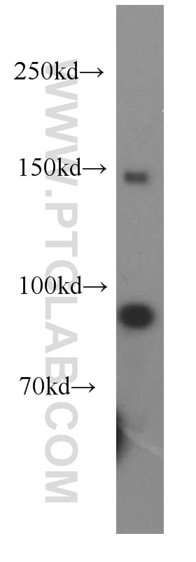 Western Blot (WB) analysis of mouse testis tissue using PLOD2-Specific Polyclonal antibody (21214-1-AP)