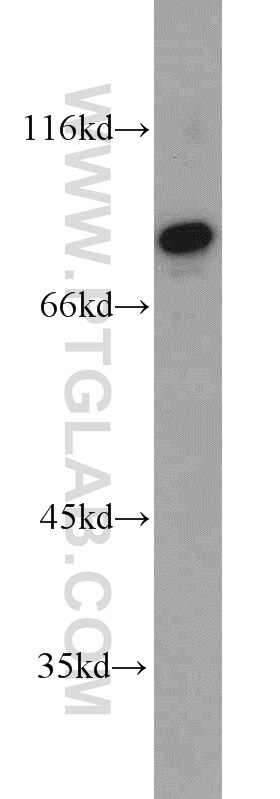 Western Blot (WB) analysis of mouse liver tissue using PLOD2-Specific Polyclonal antibody (21214-1-AP)