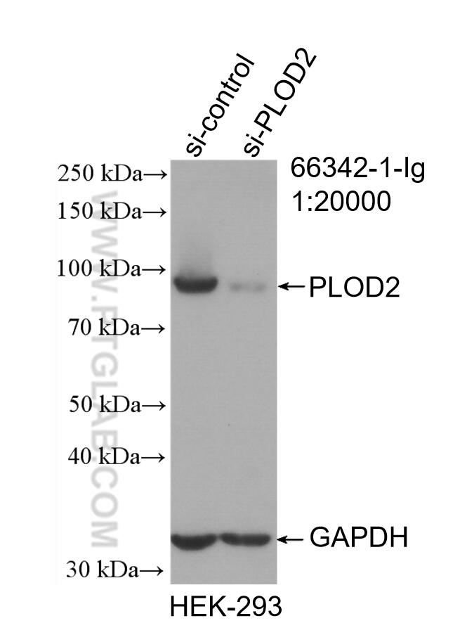 Western Blot (WB) analysis of HEK-293 cells using PLOD2 Monoclonal antibody (66342-1-Ig)