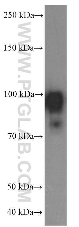 Western Blot (WB) analysis of A431 cells using PLOD2 Monoclonal antibody (66342-1-Ig)