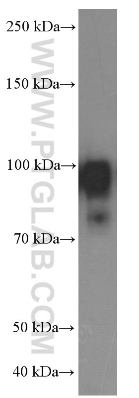 Western Blot (WB) analysis of A431 cells using PLOD2 Monoclonal antibody (66342-1-Ig)