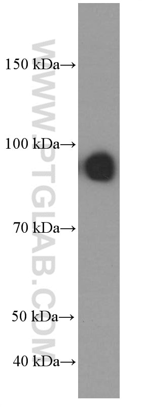 Western Blot (WB) analysis of DU 145 cells using PLOD2 Monoclonal antibody (66342-1-Ig)